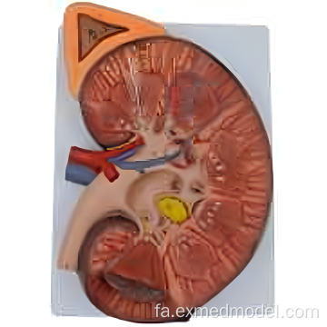 مدل آناتومی کلیه بزرگ شده